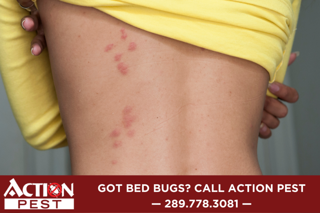 Bed Bug Rash How To Relieve Them Action Pest Control Services