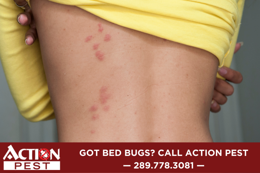 Bed Bug Rash How To Relieve Them Action Pest Control Services 4127